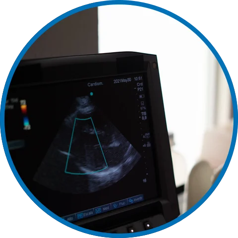 Un esame ecocolordoppler in corso